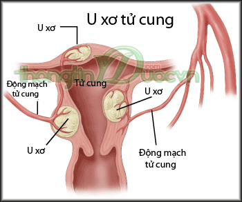 Bat benh tu chung chuot rut trong ngay den do-Hinh-2