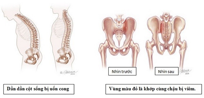 Bat benh tu chung chuot rut trong ngay den do-Hinh-4