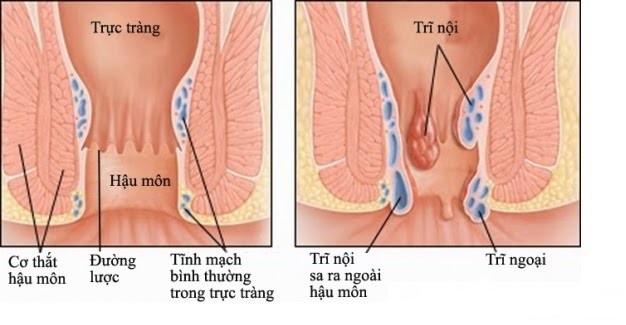 15 bai thuoc tri benh cuc tot tu cay hoa mao ga trang-Hinh-12