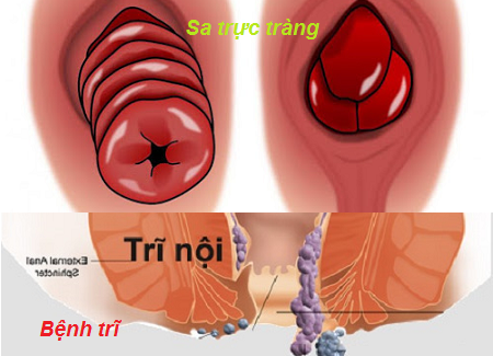 Hat tieu khong chi la gia vi, dung chua benh cung rat tot-Hinh-3