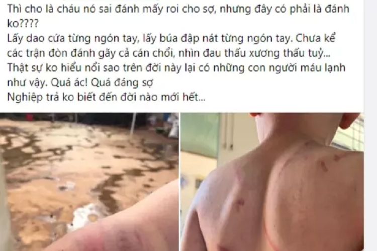 Be trai 9 tuoi bi bo va ba noi danh dap kinh hoang-Hinh-4