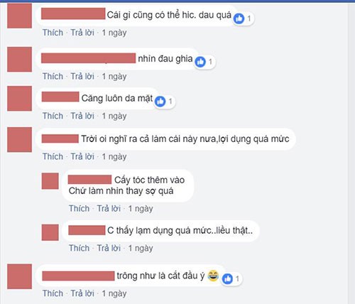 Rung minh dich vu... cat bo da dau de sua tran bot cao-Hinh-5