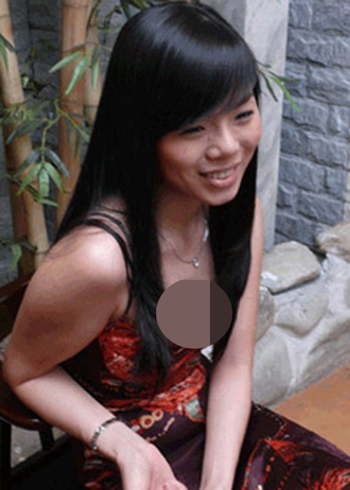 Tinh hinh moi nhat cua Le Quyen sau khi thao sun mui-Hinh-7