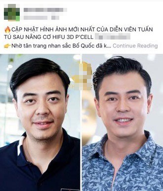 Lo anh khac la cua Tuan Tu “Ve nha di con” nghi tham my