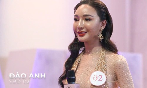 Dai su hoan my 2020 dinh lien hoan lum xum khi vua len song