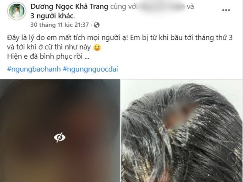 Kha Trang len tieng sau vu bi bao hanh da man