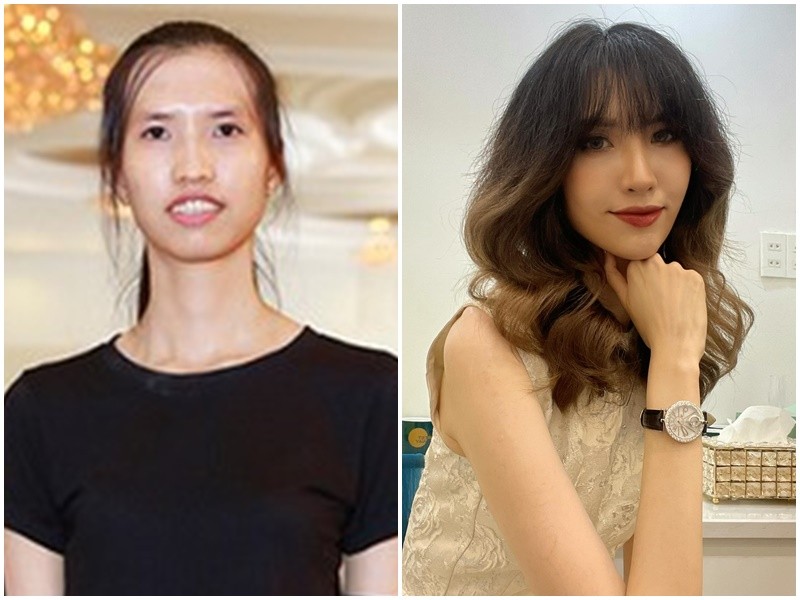 Cao 1m91, Hong Xuan cua Vietnam’s Next Top Model gio sao?-Hinh-3