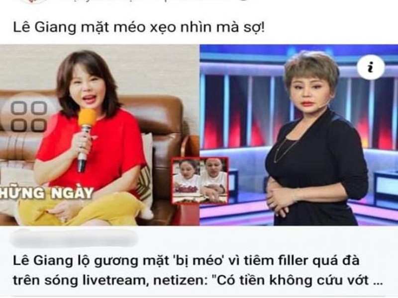 Le Giang phu nhan tiem filler “meo mat”, tung me dao keo the nao?