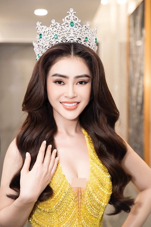 Ly Kim Thao bi tai nan, rut khoi Miss Universe Vietnam... nhan sac co anh huong?-Hinh-6