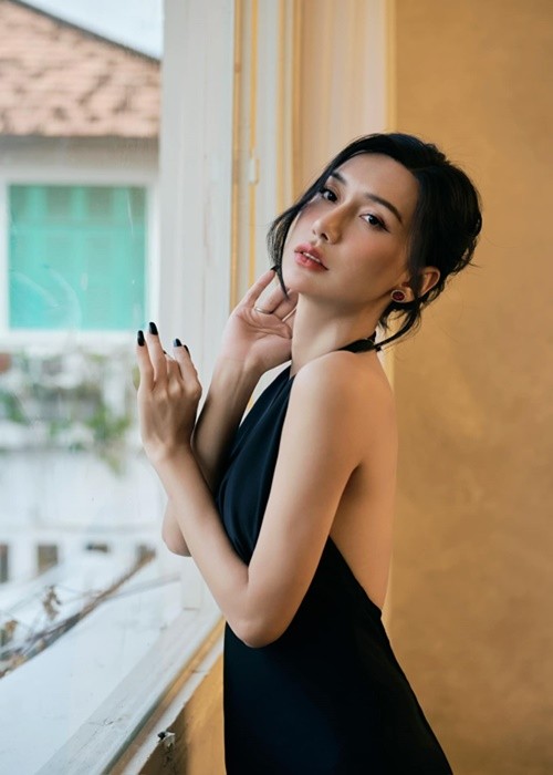 Nhan sac Lynk Lee sau 4 nam phau thuat chuyen gioi-Hinh-3