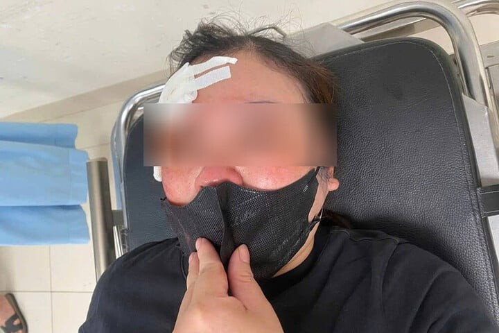 Người phụ nữ bị tài xế dùng dùi cui vụt vào đầu Nguoi phu nu bi tai xe dung dui cui vut vao dau