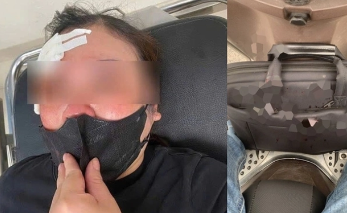 Nguyên nhân vụ người phụ nữ đi xe máy bị đánh vào đầu Nguyen nhan vu nguoi phu nu di xe may bi danh vao dau