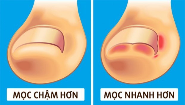 Vi sao mong tay moc dai nhanh hon mong chan?-Hinh-5