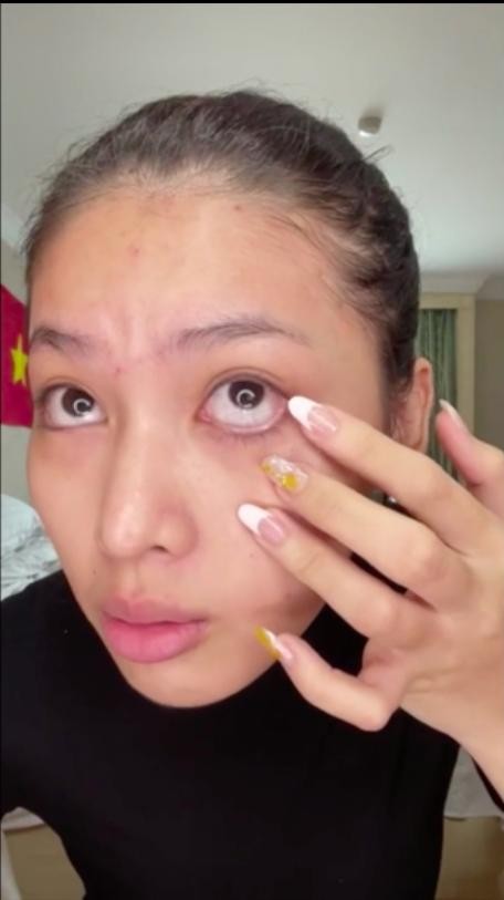 Ngoc Thao lo moi tham, da day mun sau lop make up vi dieu-Hinh-7