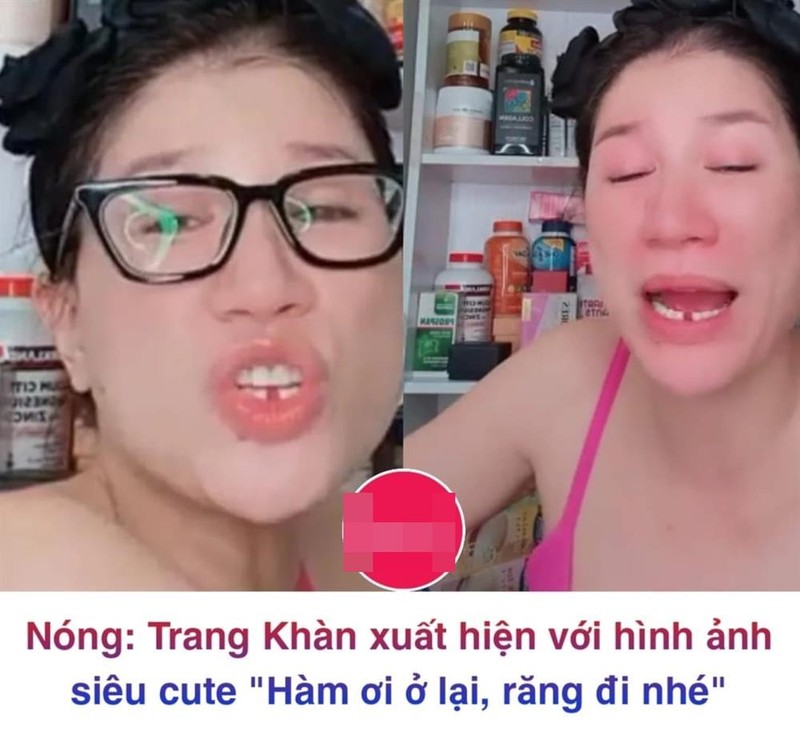 Cuoi xiu ly do khien Trang Tran gay rang cua-Hinh-3