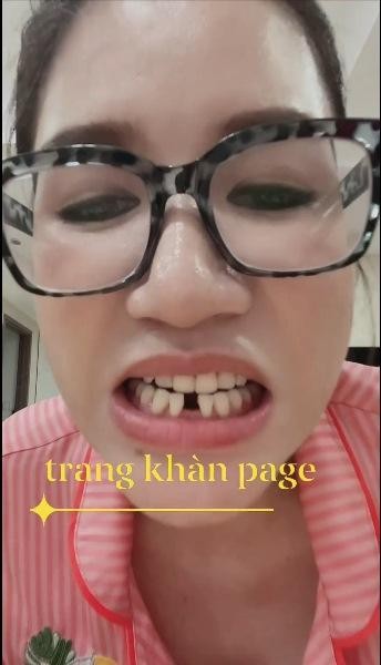 Cuoi xiu ly do khien Trang Tran gay rang cua-Hinh-6