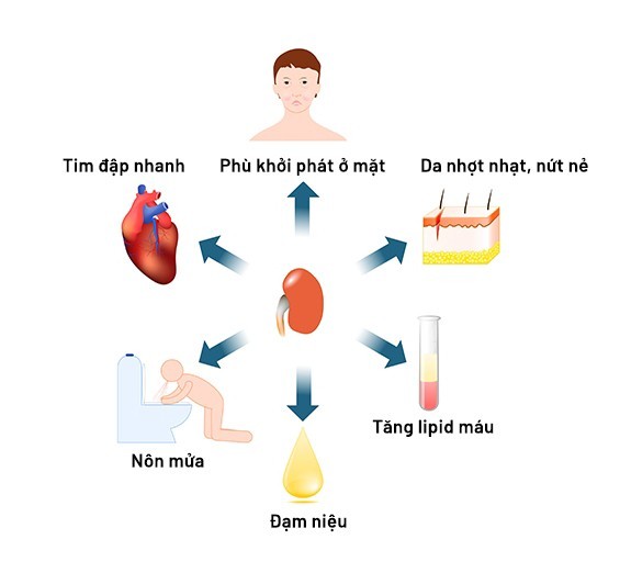 Nguyen nhan gay hoi chung than hu va cach dieu tri