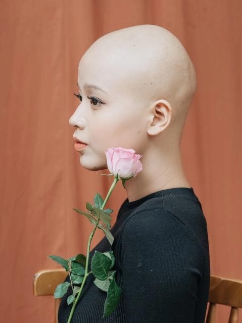 Girl who overcame cancer registers for beauty pageant-Picture-3