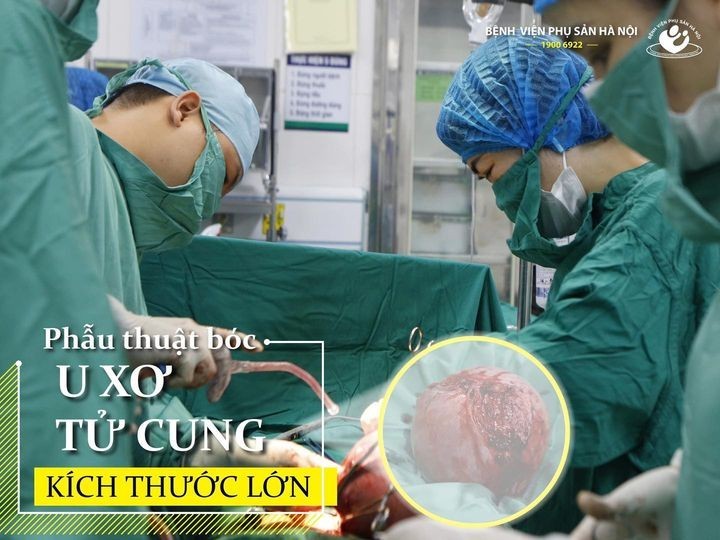 Phai cat tu cung vi chu quan de u 10 nam moi di kham