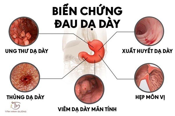 5 sai lam lam ton thuong da day khong nen xem thuong