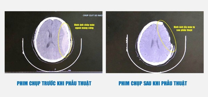 Cuu song nguoi dan ong hon me do nga thang 3m