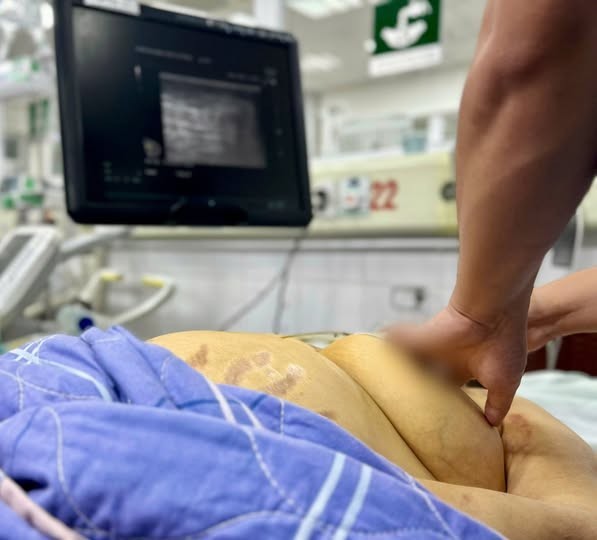 Suy gan nguy kịch do chủ quan với viêm gan B - Hình 3 Suy gan nguy kich do chu quan voi viem gan B-Hinh-3