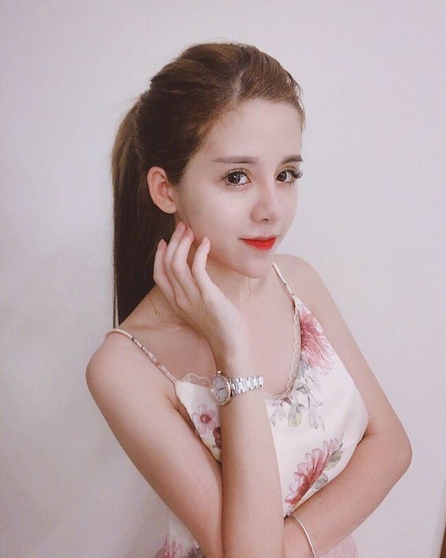 Ngam anh truoc va sau phau thuat tham my cua vo sap cuoi Huy Cung-Hinh-2