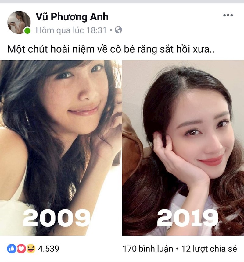 Ket qua khi cac hot teen Viet tham gia trao luu 10 year challenge-Hinh-3