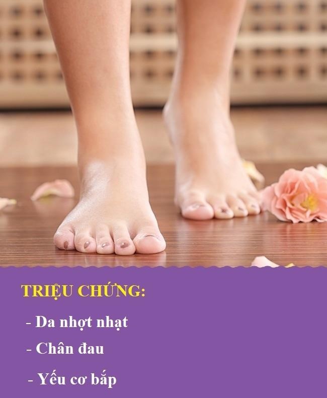 Chan sung, dau - dau hieu canh bao benh nguy hiem-Hinh-7