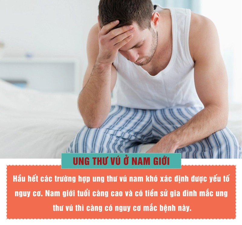 Nam gioi dung bo qua khi thay khoi u duoi nguc-Hinh-3