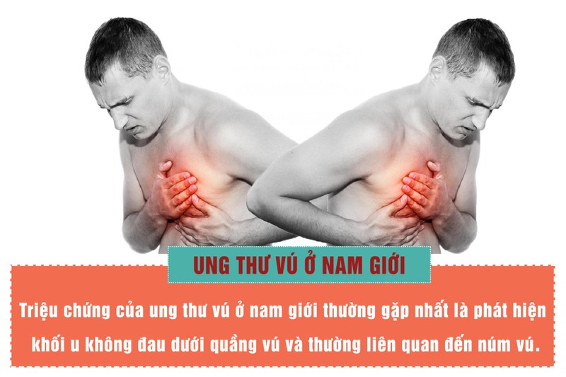 Nam gioi dung bo qua khi thay khoi u duoi nguc-Hinh-4