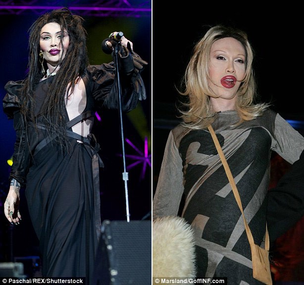 Pete Burns thay doi the nao sau 300 lan phau thuat tham my-Hinh-4