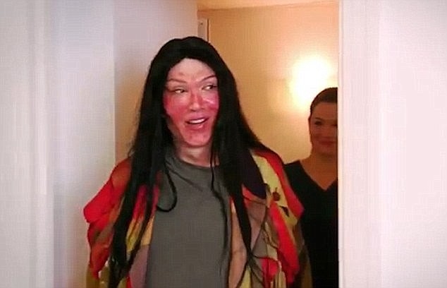 Pete Burns thay doi the nao sau 300 lan phau thuat tham my-Hinh-7