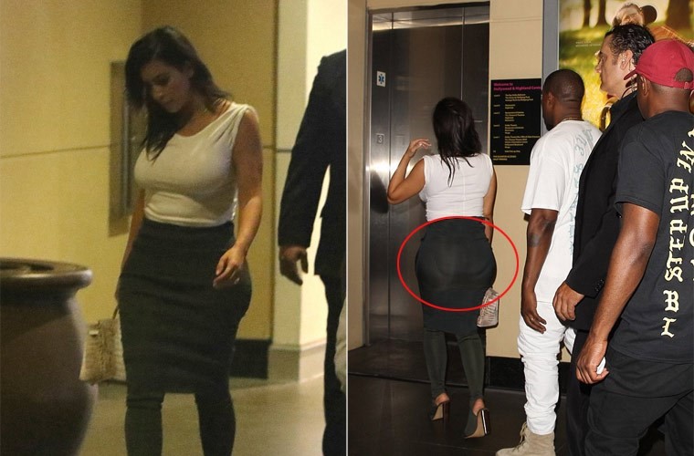 Chi em Kim Kardashian nhieu lan bi nghi phau thuat tham my-Hinh-5