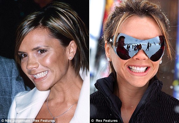 Day la ly do tai sao Victoria Beckham hiem khi cuoi-Hinh-3