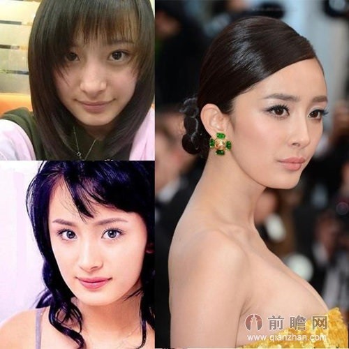 Angelababy, Duong Mich phat tai nho phau thuat tham my-Hinh-7