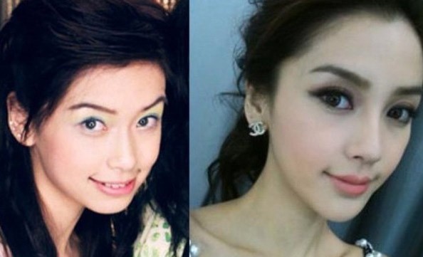 Angelababy, Duong Mich phat tai nho phau thuat tham my