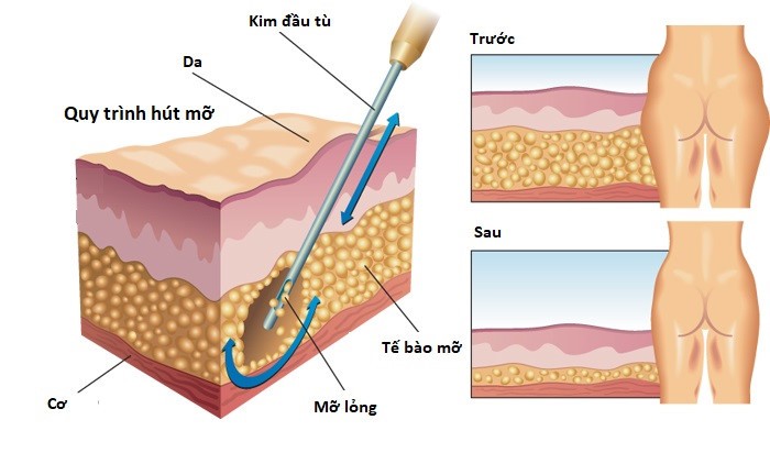 So phan bi tham cua co gai dau tien hut mo trong lich su-Hinh-2