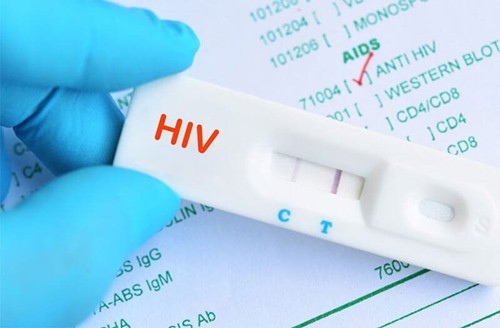 Tuong nhiem HIV suy sup suyt chet, 5 nam sau biet xet nghiem nham