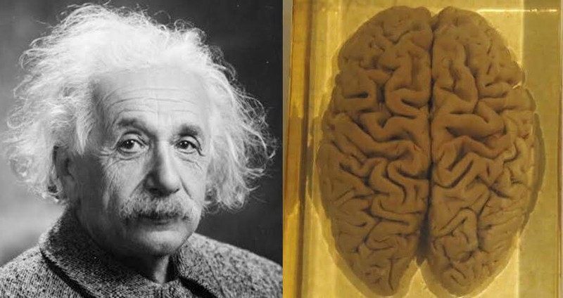 Bo nao cua thien tai Einstein duoc 