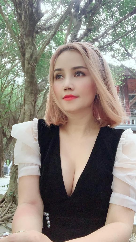 Dao Hoang Yen tang ngay mot ty neu co nguoi noi co tiem filler-Hinh-3