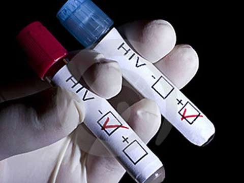 Lan dau tien ap dung tu xet nghiem HIV tai Viet Nam