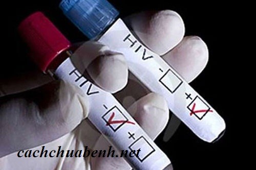 Can canh các buoc xu ly khan cap khi phoi nhiem HIV-Hinh-14