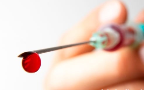 Xu ly the nao khi vo tinh bi phoi nhiem HIV?