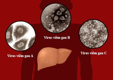 Tại sao nguòi viem gan hon me sau nhu MC Quang Minh?-Hinh-10