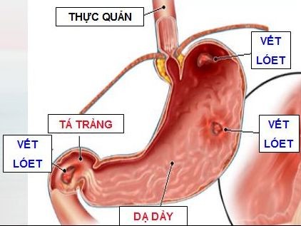 Top bai thuoc hay tu thit meo chua benh cuc tot-Hinh-8