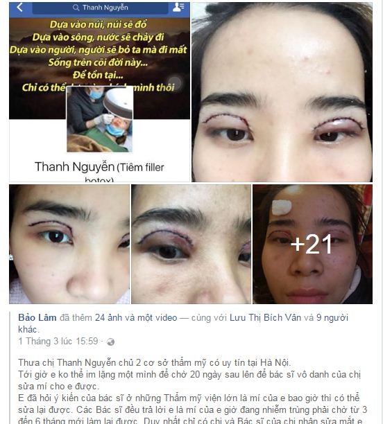 Spa Thanh Nguyen 465 Thuy Khue: Cat mi gay nhiem trung cho khach-Hinh-2