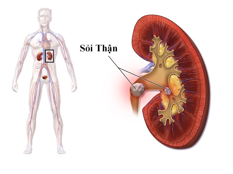 Bai thuoc chua benh tu loai hoa cua mat troi-Hinh-10