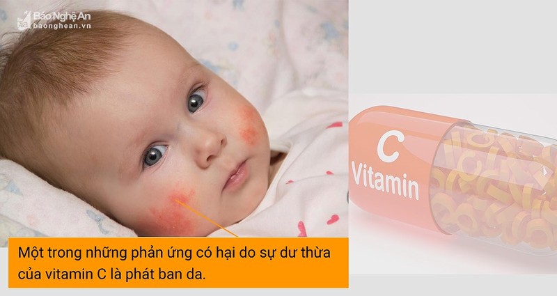 6 can benh tiem an khi “tieu thu” qua nhieu vitamin C-Hinh-4