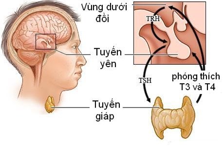 Ly do bat ngo khien ban khong the giam can, thoat u map